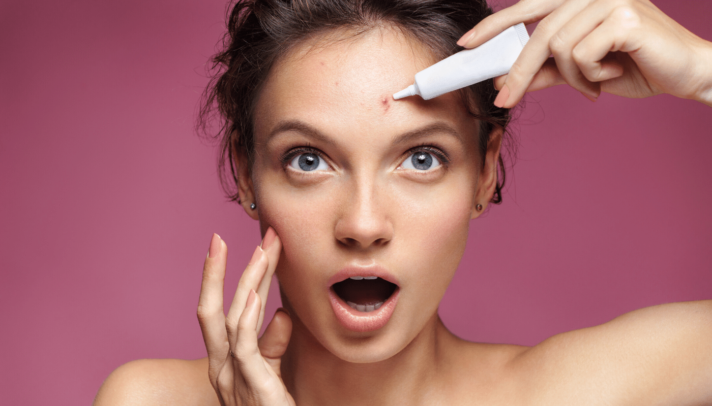 Effective Aloe Vera Acne Treatment: Unlock Clear, Radiant Skin