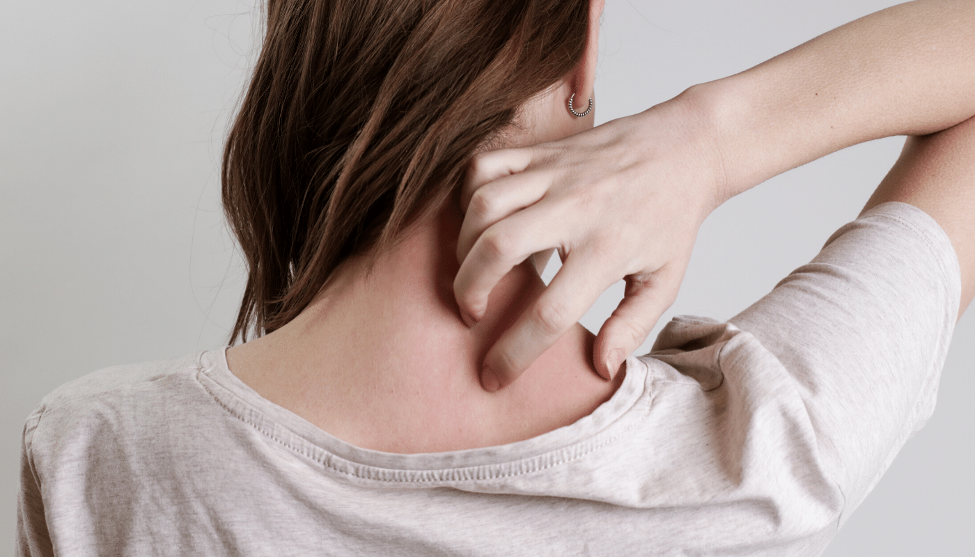 Aloe Vera for your Psoriasis treatment